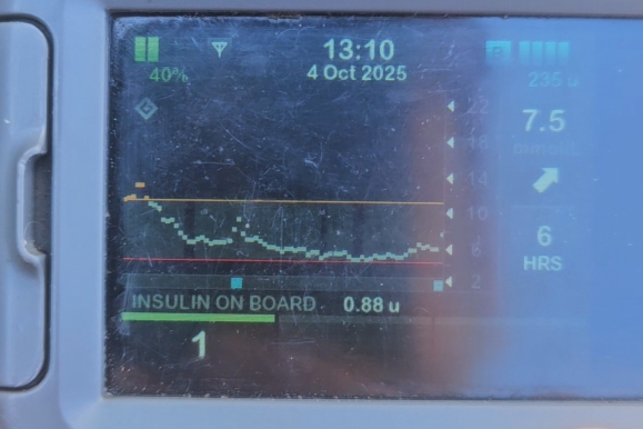 50k post-race Blood Sugar and Nutrition analysis